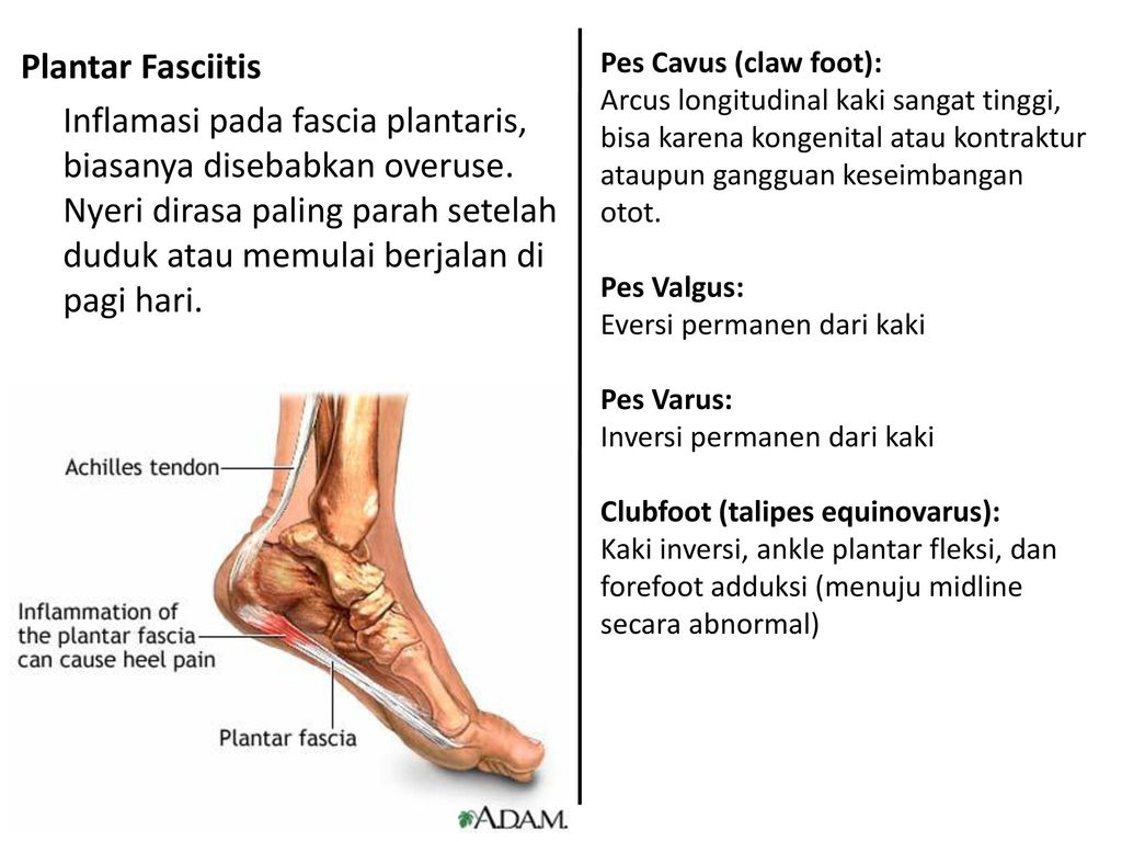 Cual es el mejor castaño para plantar